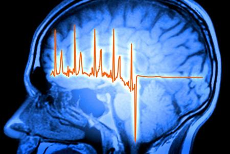 مغز،اخبار پزشکی،خبرهای پزشکی